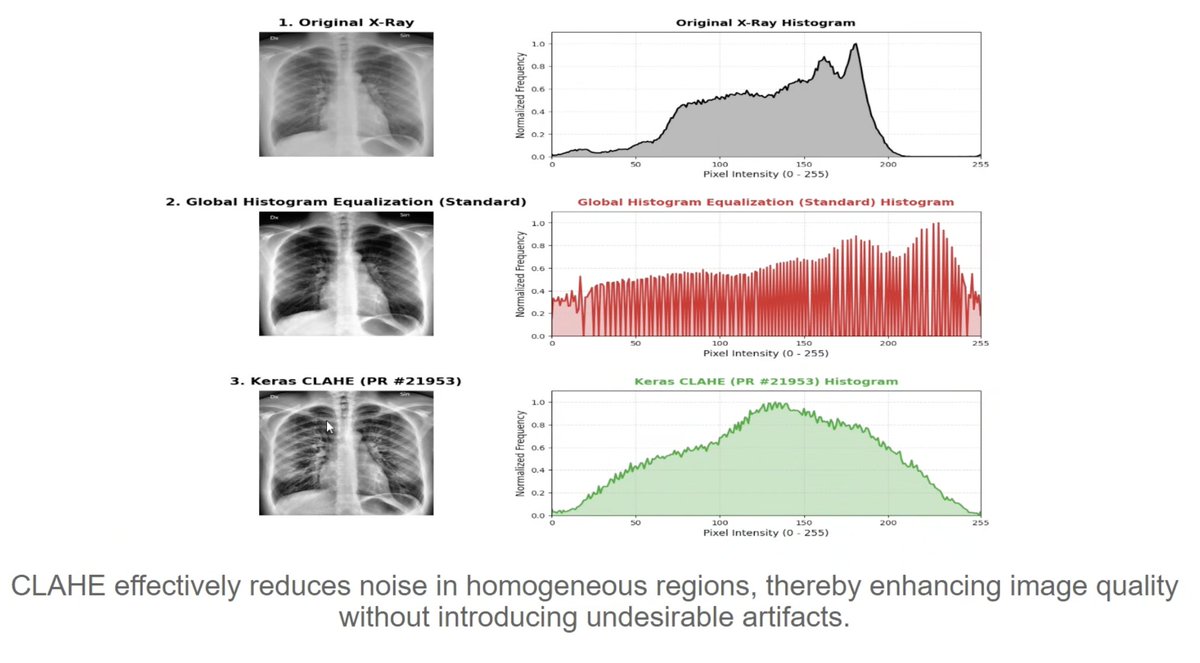 Keras Community Contribution: New CLAHE Image Preprocessing Layer