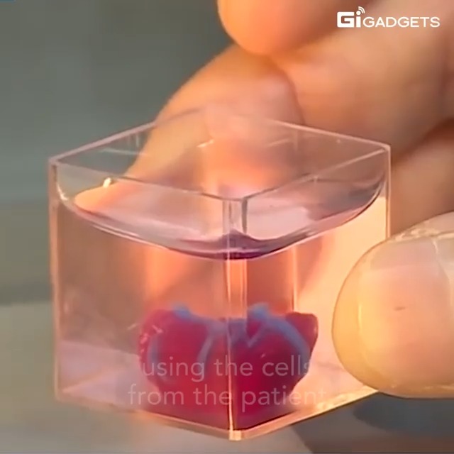 3D Printed Hearts Using Patients’ Cells: Medical Technology Advancement