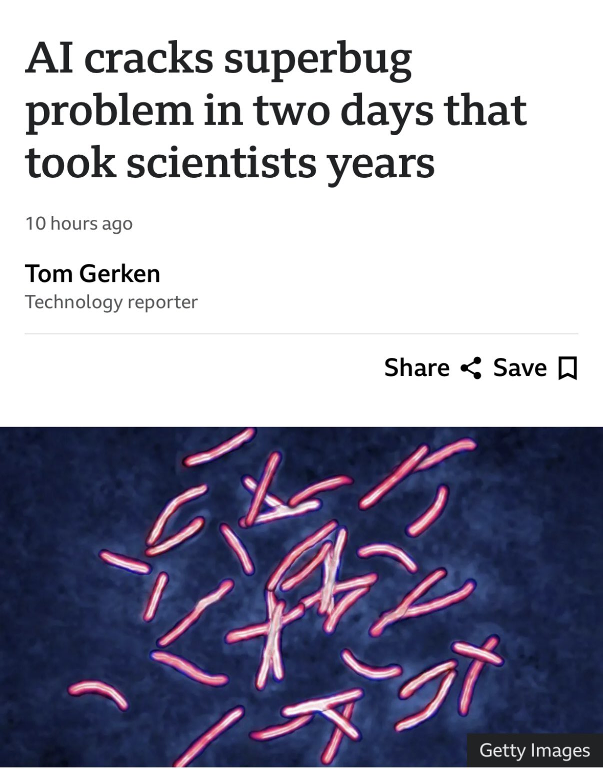 Autocomplete Features Becoming Excessive in AI Tools