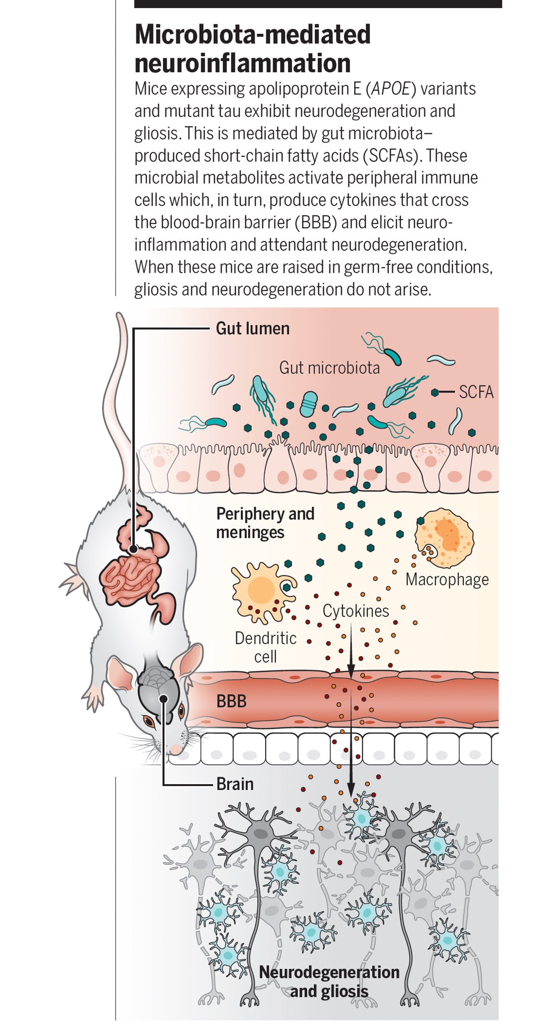 Gut Microbiota Could Prevent Alzheimer’s Disease Progression