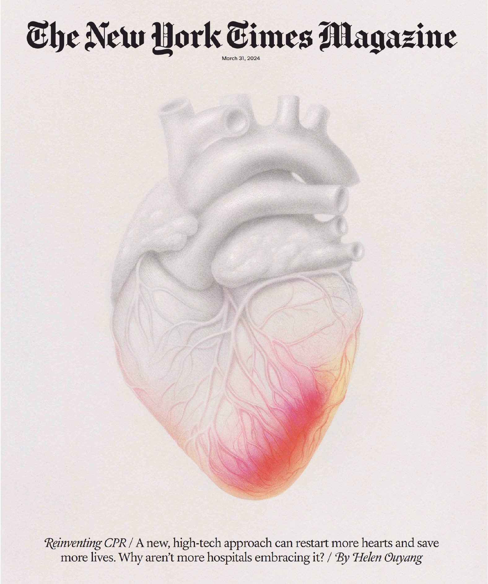 ECPR procedure achieves near-perfect cardiac arrest revival rates