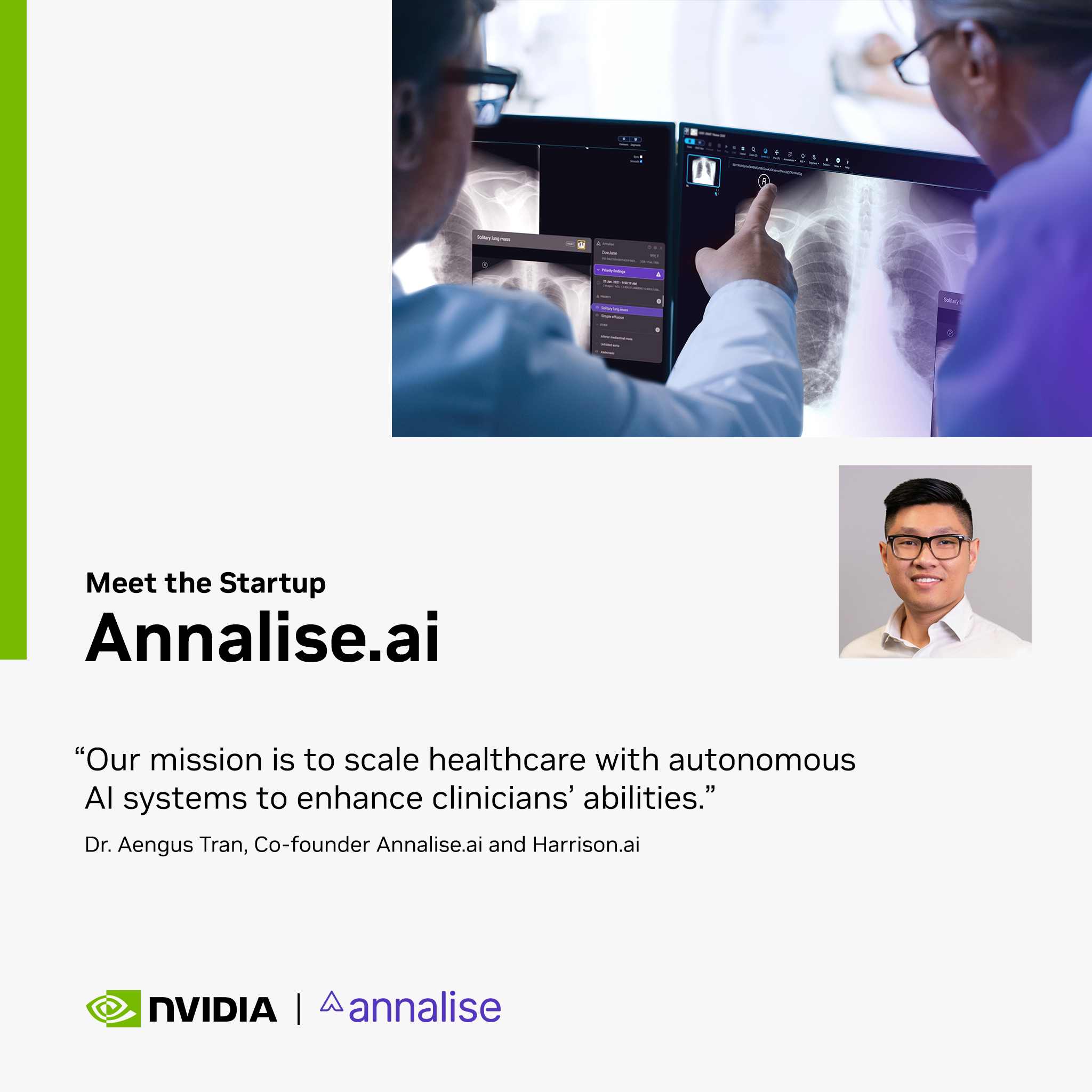 AI Radiology Analysis Enables Faster, More Accurate Diagnoses