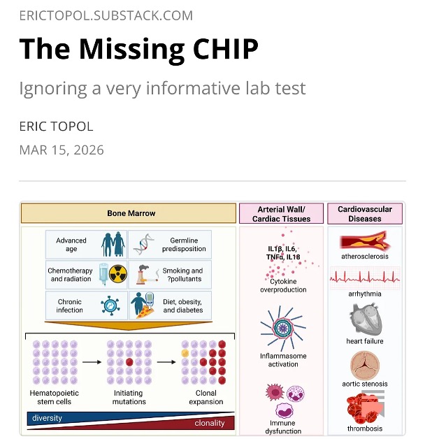 The Missing Chip: Critical Hardware Gap in AI Development