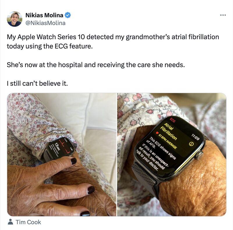 Apple Watch AI detects critical health conditions and saves lives