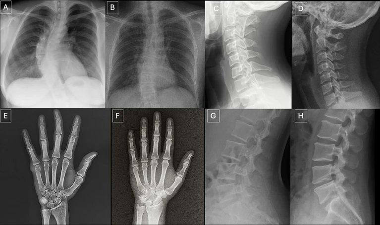 Radiologists and AI fail to spot deepfake medical scans.