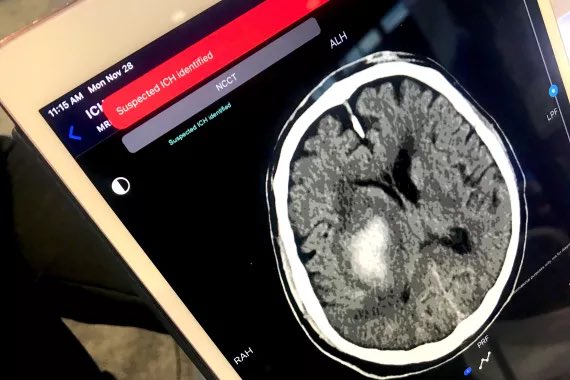 FDA Approves 500+ AI Algorithms for Medical Imaging Detection