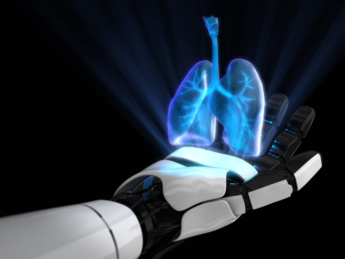 AI Detects Early Lung Cancer Signs Invisible to Doctors
