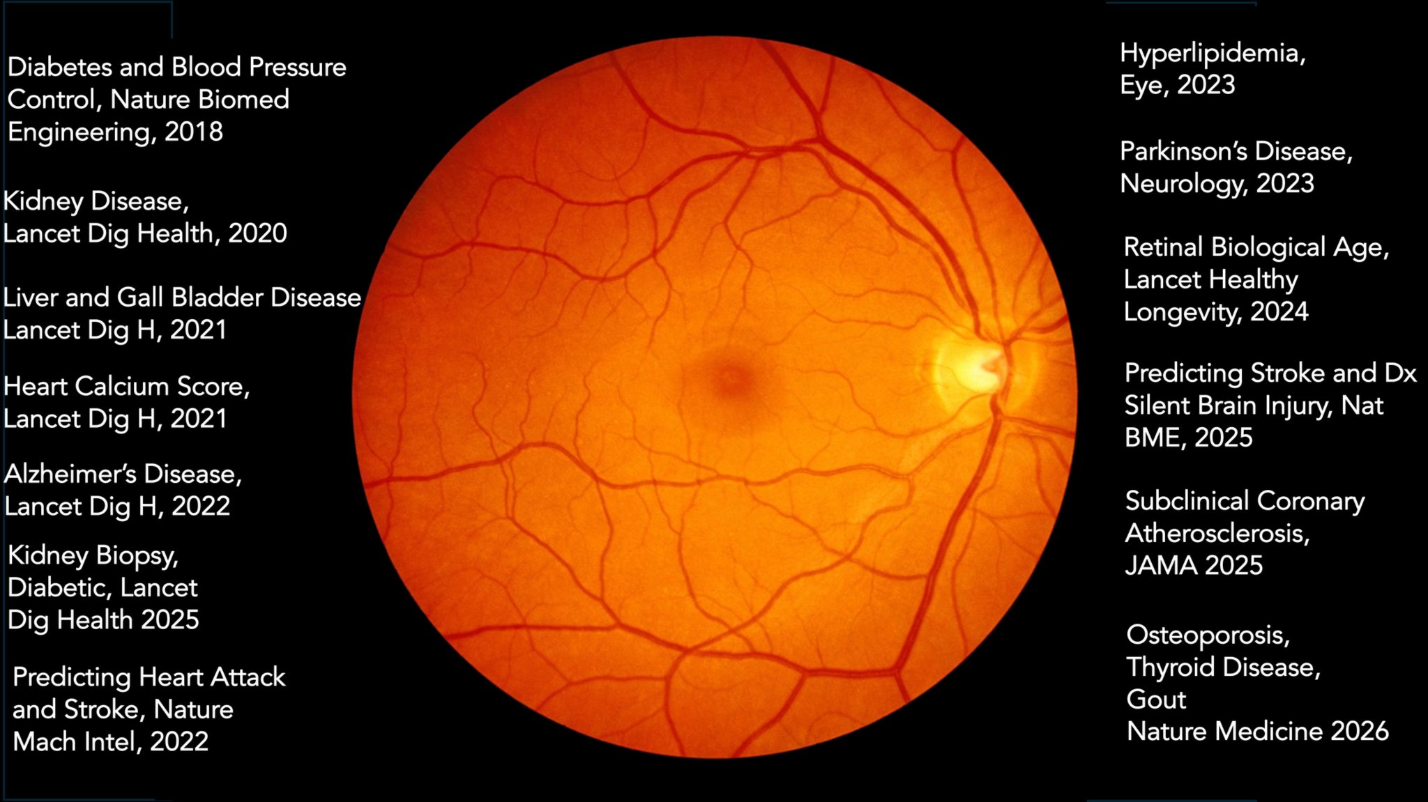 AI detects osteoporosis from retinal images in new study