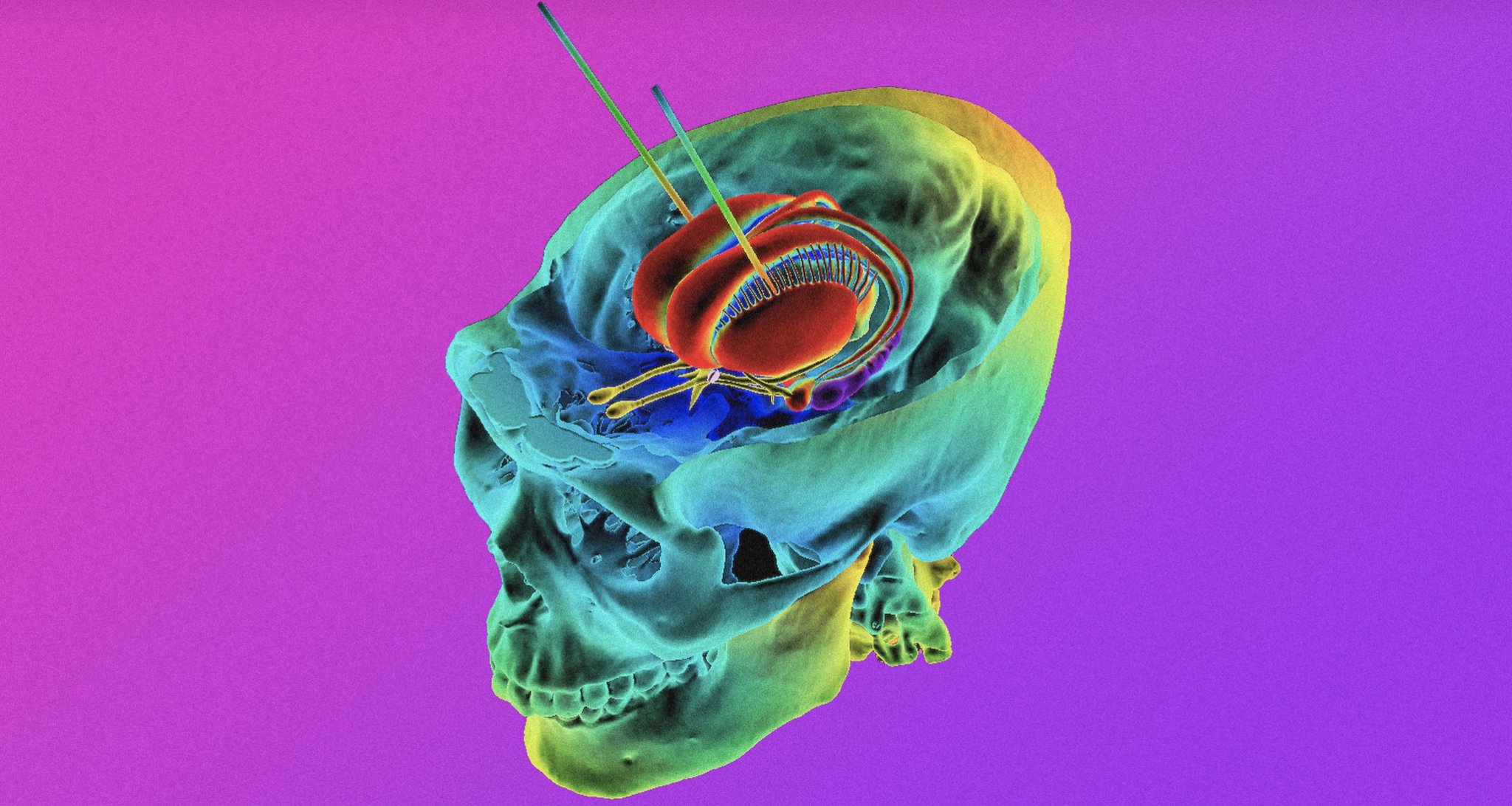 Brain Stimulation Technology Raises Data Privacy Ethics Concerns