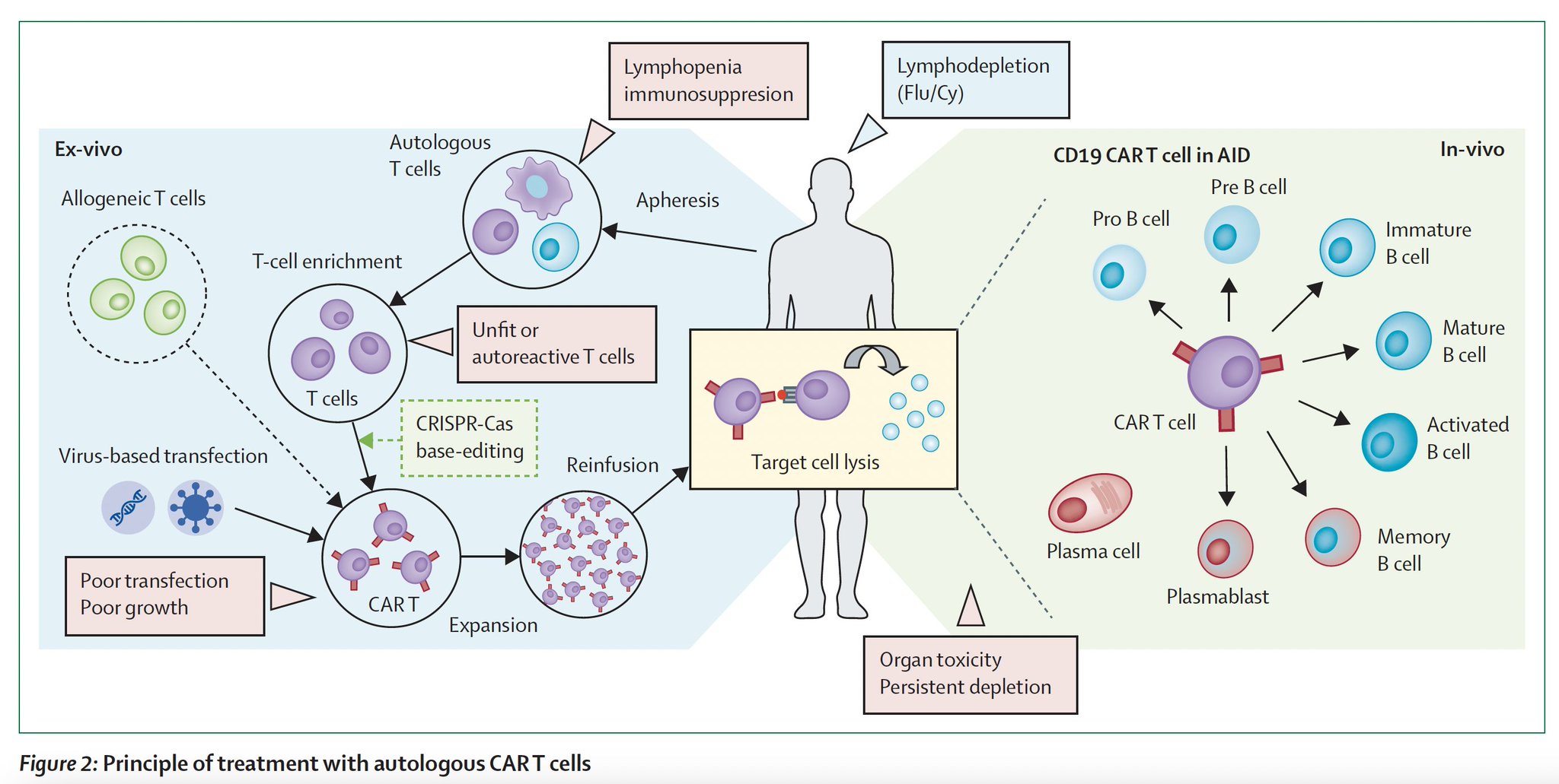 CAR-T Cell Engineering Shows Promise for Lupus Autoimmune Treatment