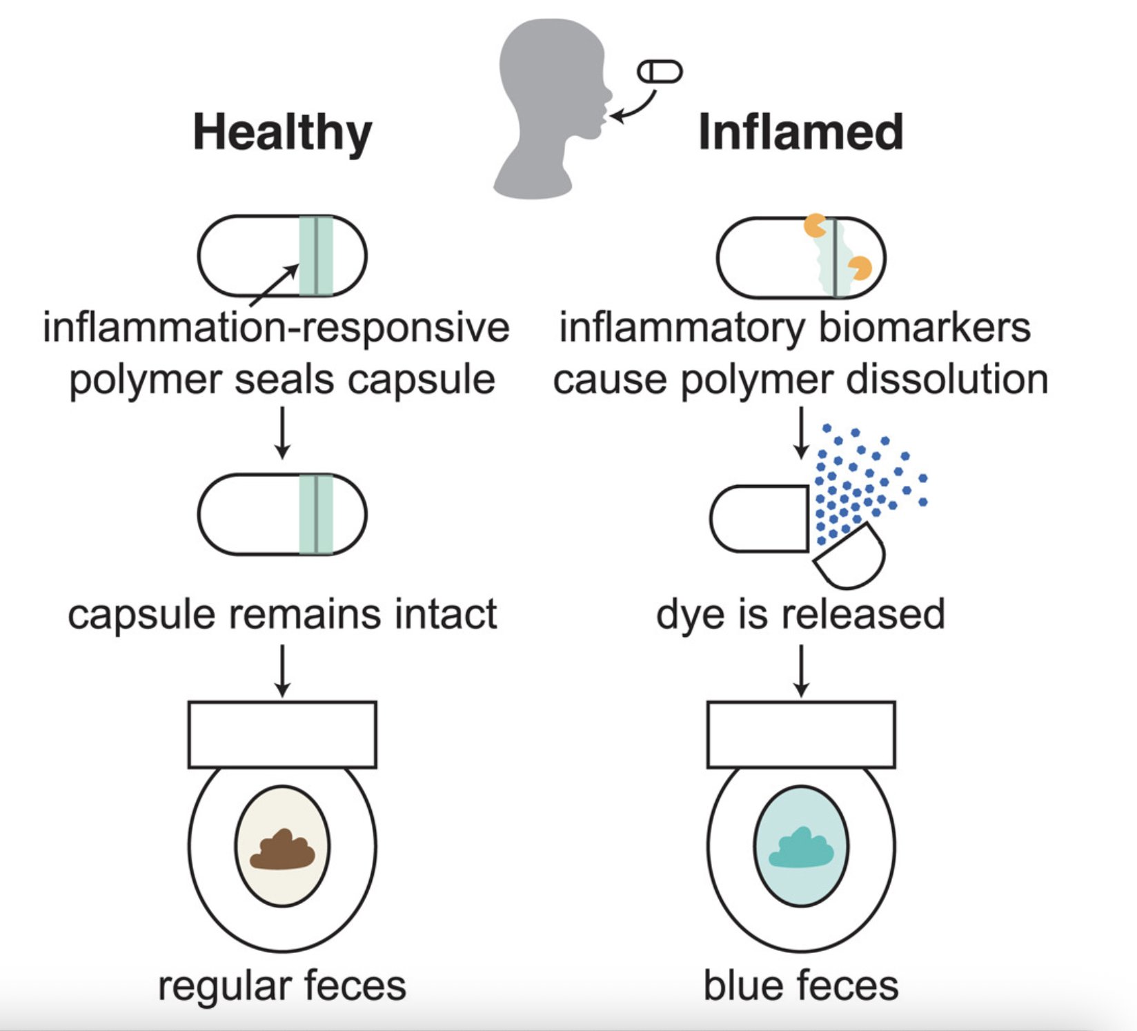 Ingestible Pill Innovation Monitors Gut Inflammation