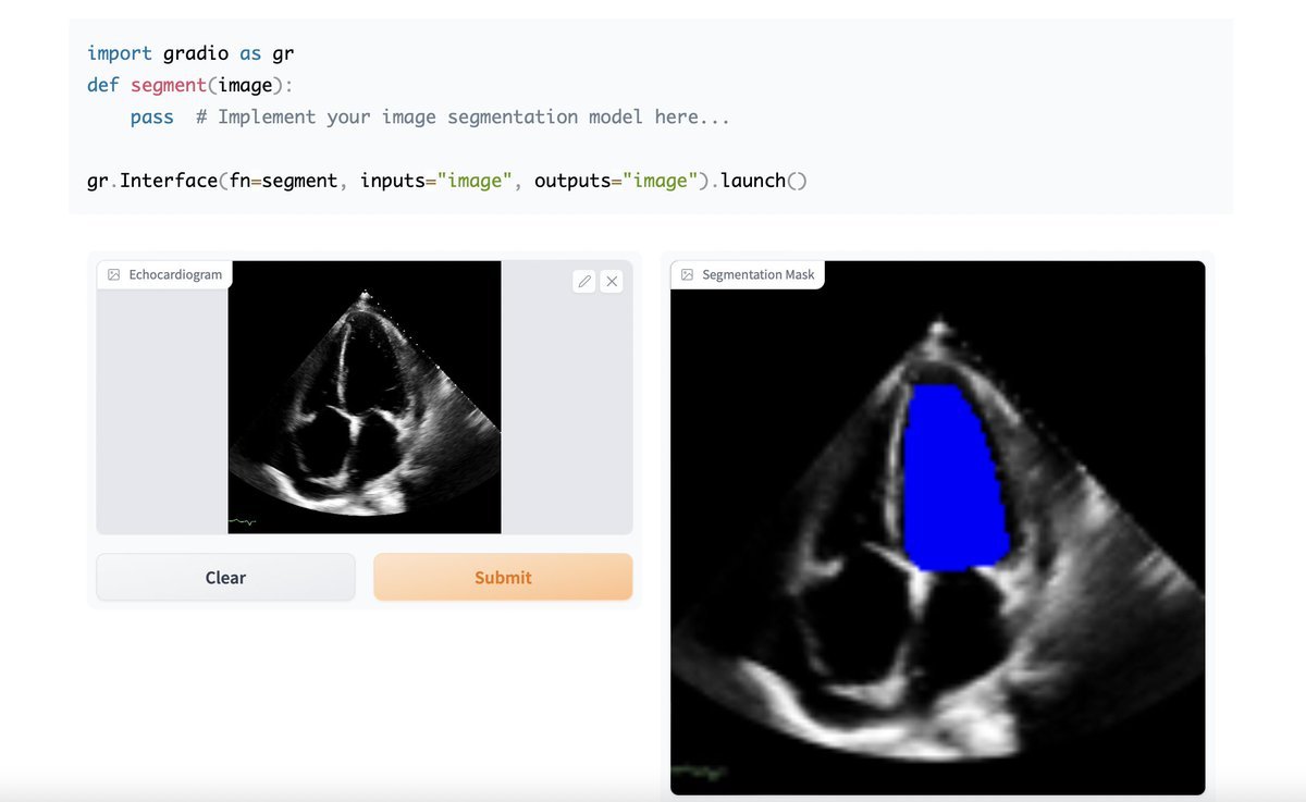 Gradio: Fast Web Interface for ML Models Demo