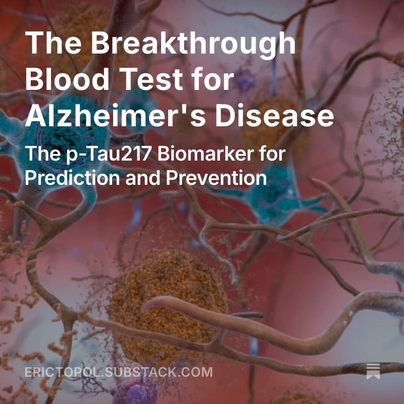 AI Test Predicts Alzheimer’s Onset with Lifestyle Factors