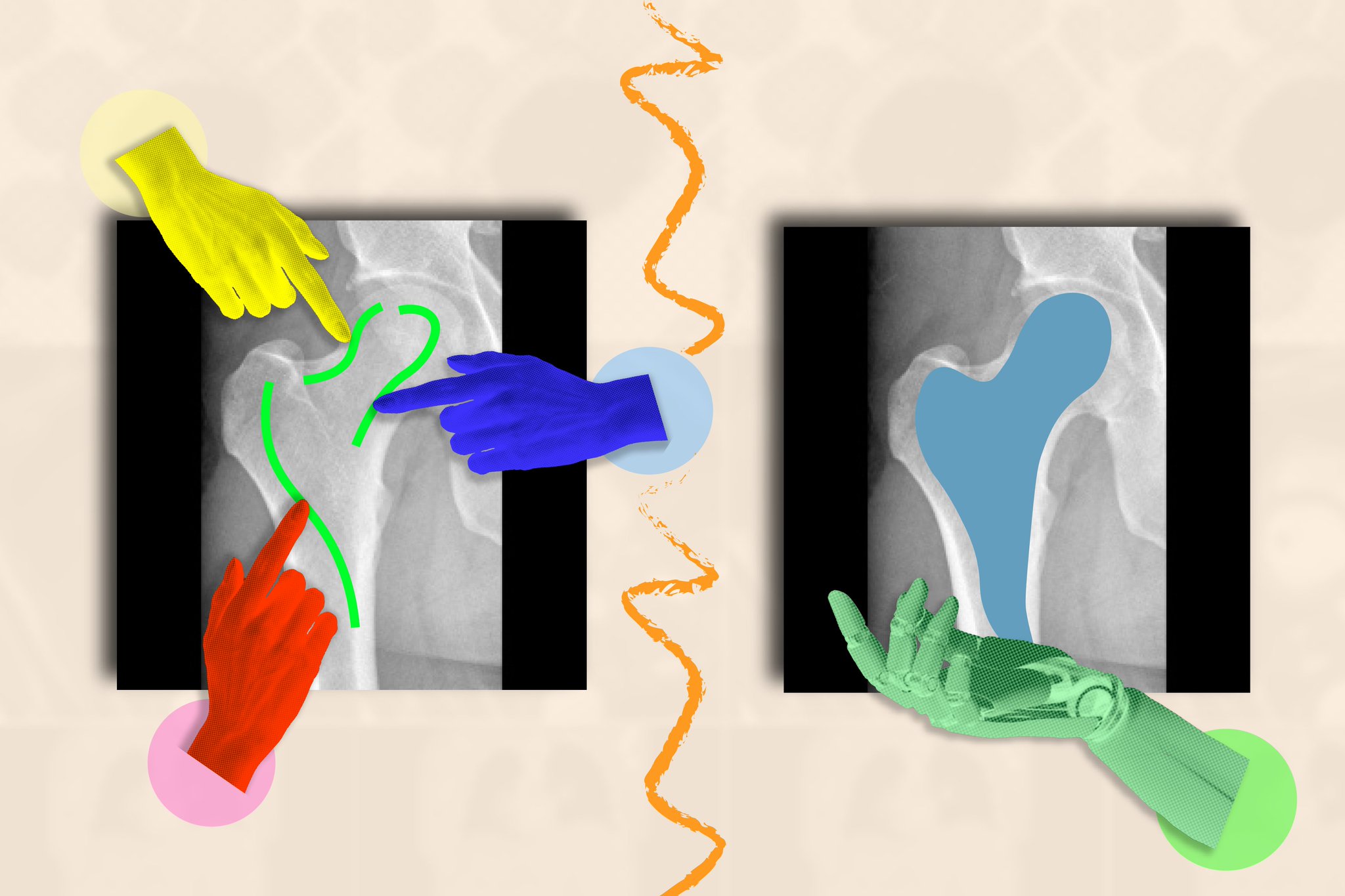 AI Simulates Medical Image Annotation for Faster Training