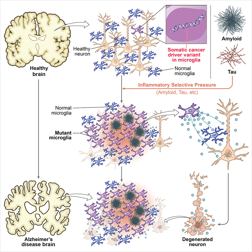 Somatic Mutations in Microglia Drive Alzheimer’s Neuroinflammation