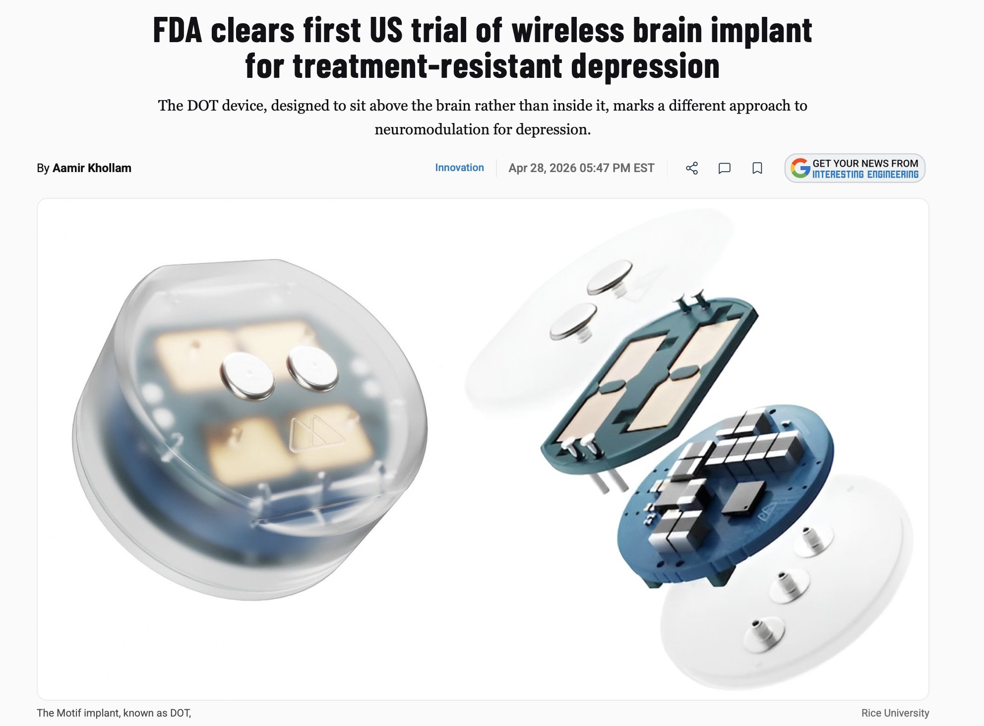 Motif Neurotech Gets FDA Clearance for Skull-Top Brain Implant