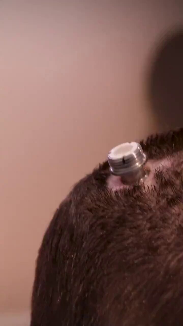 Implant Technology Converts Brain Waves Into Spoken Words