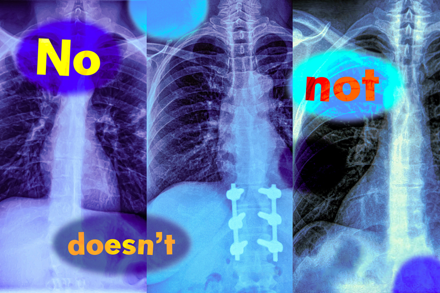 MIT Study Reveals Vision-Language Models Fail with Negation in Medical Imaging