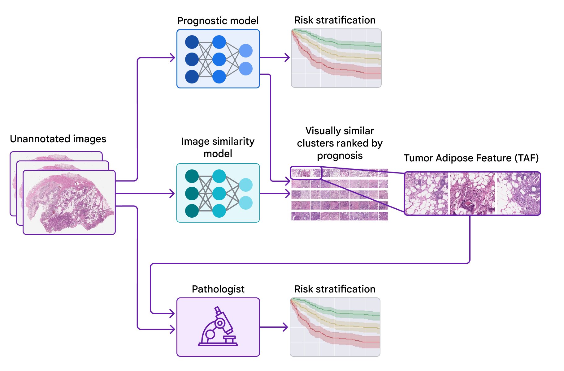 AI identifies novel colorectal cancer prognostic features