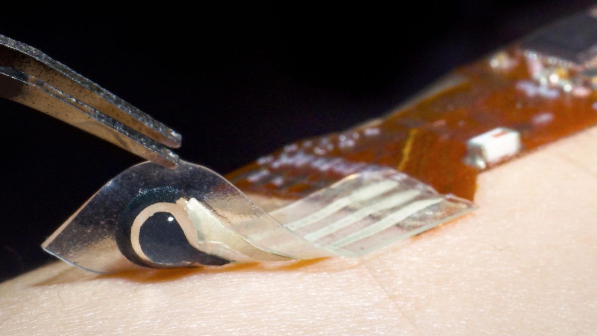 Wearable Sensor Tracks Cholesterol Lactate Without Blood Draws