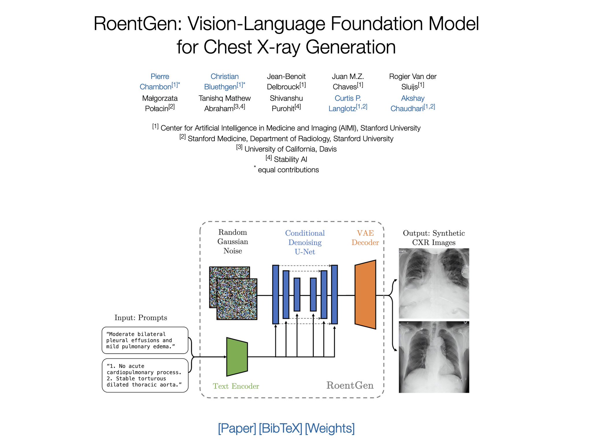 RoentGen: Vision-Language Model for Chest X-rays