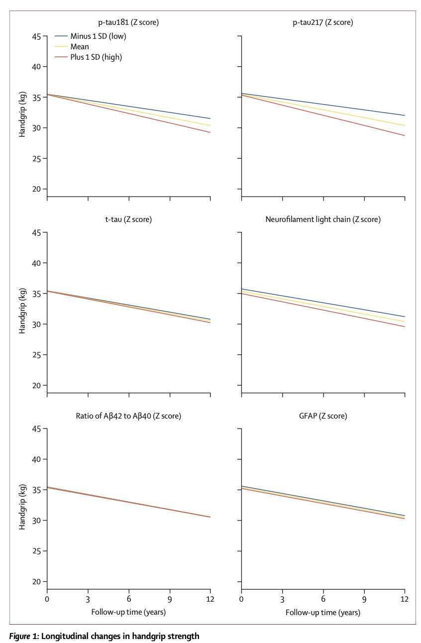 AI Biomarkers Track Muscle Strength Loss in Alzheimer’s Disease