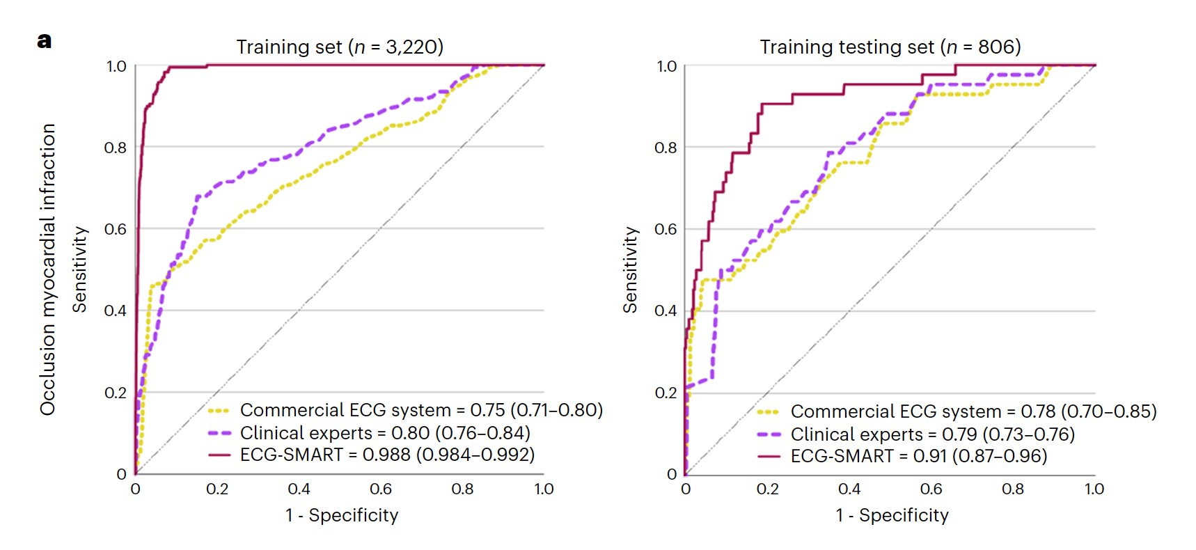 AI Outperforms Clinicians in Heart Attack ECG Diagnosis