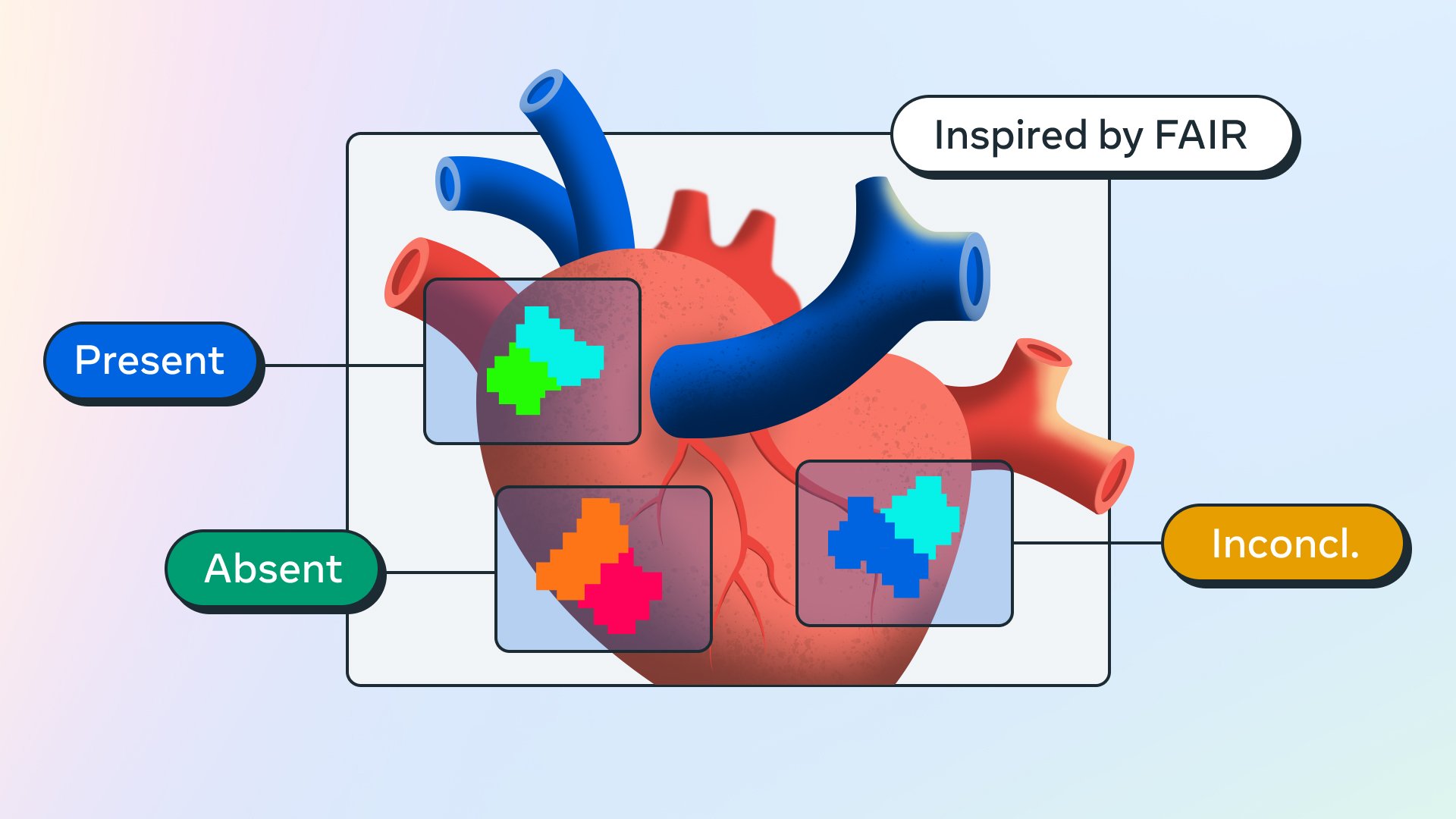 BrightHeart Uses Meta’s DINOv2 for Fetal Heart Screening