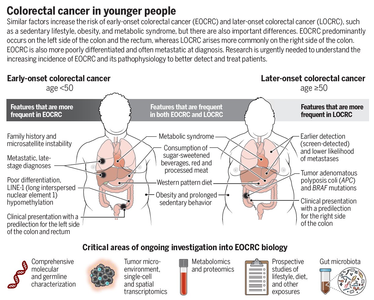 AI Research Reveals Rising Colon Cancer Cases Young Adults