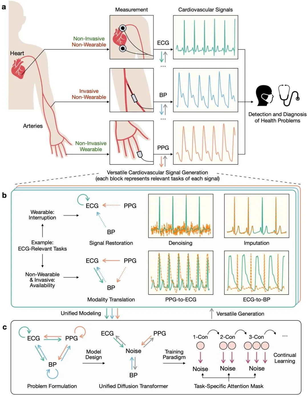 UniCardio AI Model Cleans Noisy Heart Signal Data