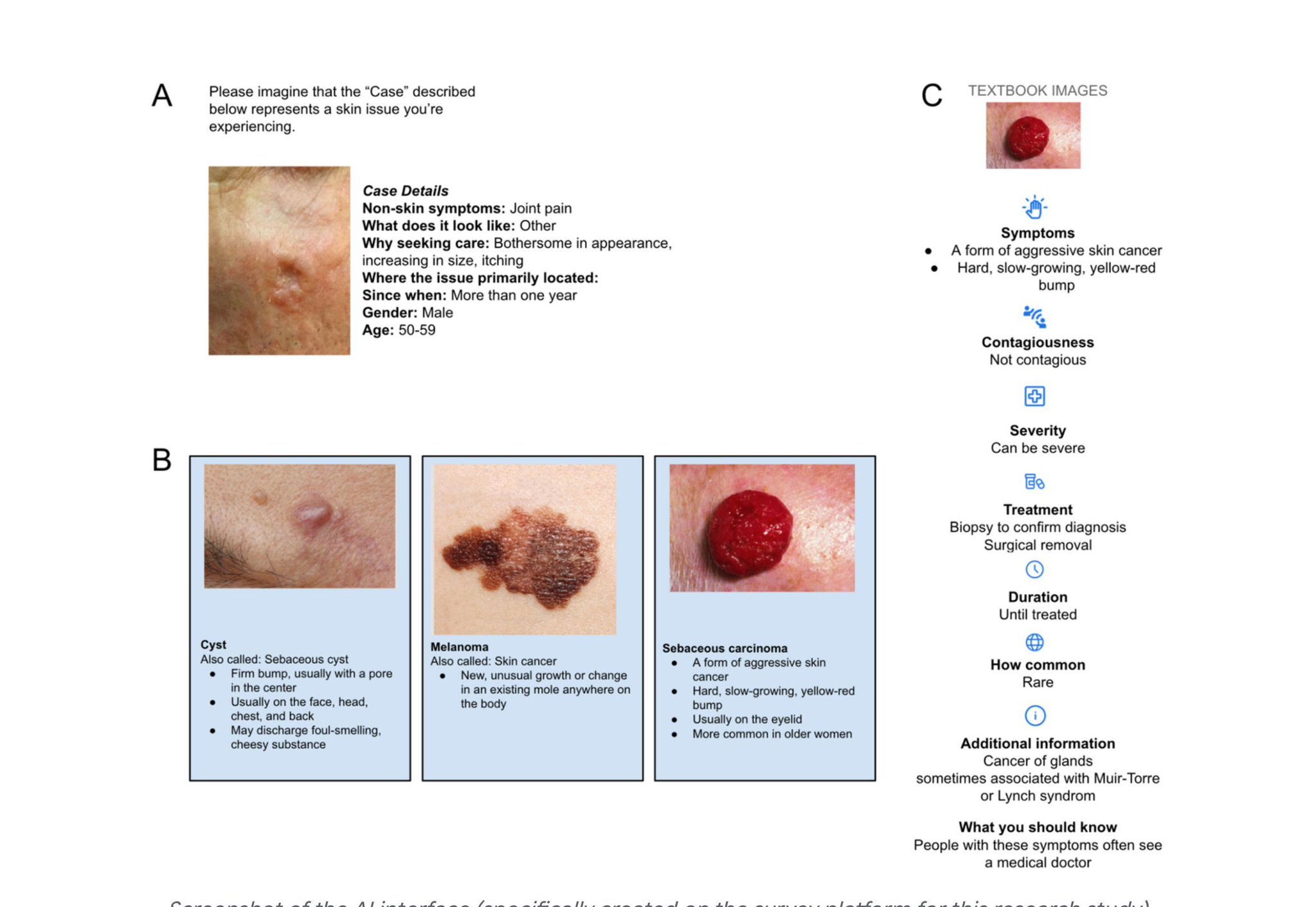 Consumer Understanding of Skin Concerns with AI Tool