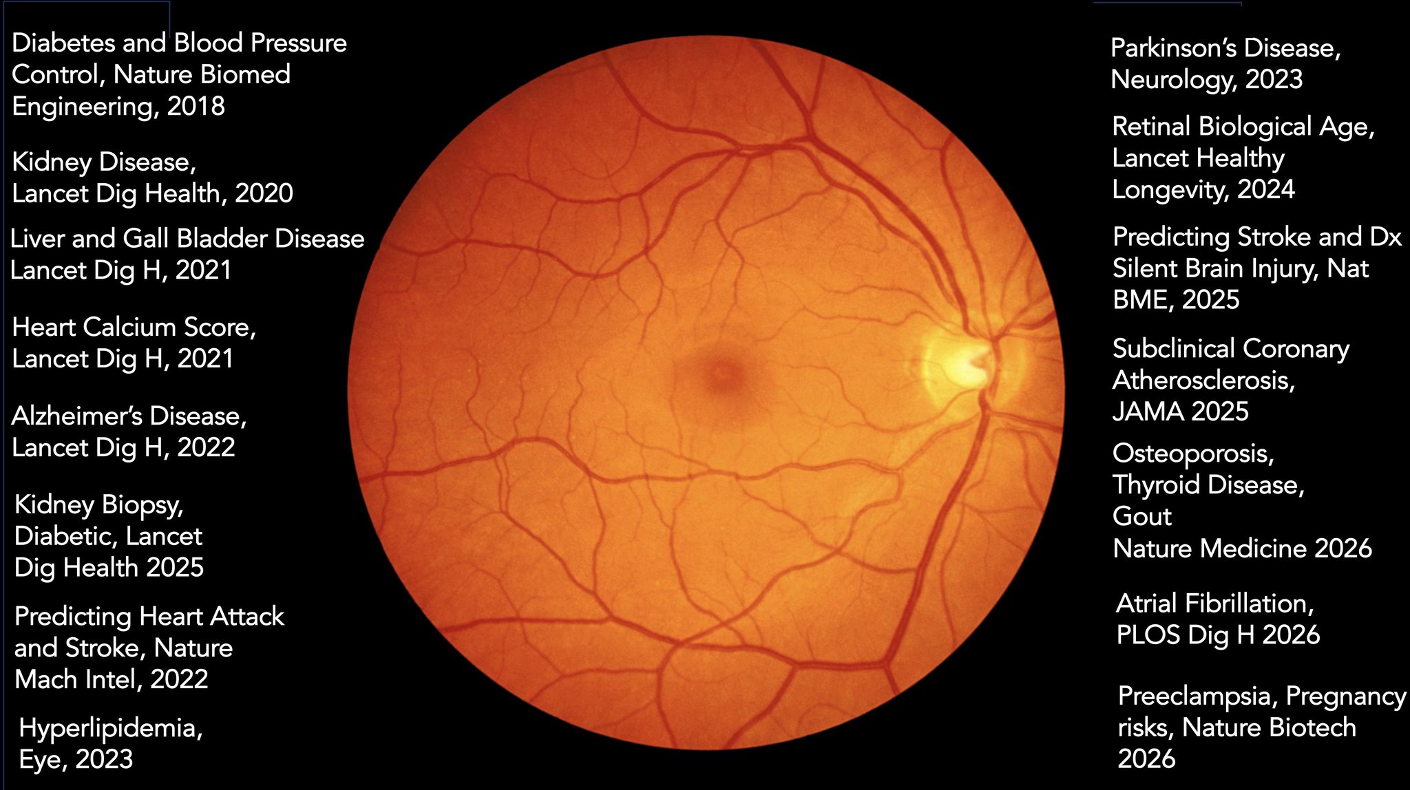 AI retina imaging predicts preeclampsia and pregnancy vascular risks