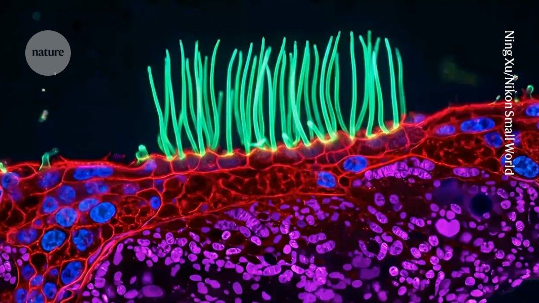 AI-generated microscopy image sparks controversy in prestigious competition